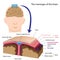 Meninges of the brain