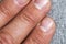 Mens fingers and nails in bad condition close up