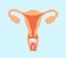 Menstrual cup