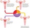 Menstrual cycle