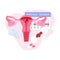 Menstruation theme background. Woman reproductive organs with calendar, tablets and dirty sanitary napkin. Illustration for first