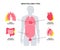 Mesothelioma tumor types