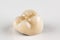Metal ceramic dental crown photographed close-up