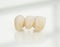 Metal free ceramic dental crowns