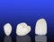 Metal free ceramic dental crowns