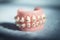 Metal orthodontic denture base