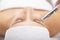 Microdermabrasion cosmetic procedure