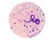 Microscopic examination of stained blood films used to differentiate microfilariae.