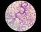 Microscopic examination of stained blood films used to differentiate microfilariae.