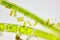 Microscopic view of a diatoms Diatoma and green algae filaments