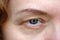 middle aged female\'s eye with drooping eyelid doing makeup. Ptosis is a drooping of the upper eyelid, lazy eye.