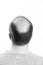 Middle-aged man concerned by hair loss Baldness alopecia Black and white