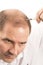 Middle-aged man concerned by hair loss Baldness alopecia Black and white