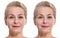 Middle aged woman face before and after cosmetic procedure. Plastic surgery concept.