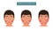 Mikulicz syndrome. Enlargement of the lacrimal and salivary glands