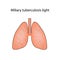 Miliary tuberculosis. Vector illustration on isolated background