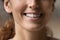 Millennial woman satisfied dental clinic patient demonstrate charming healthy smile