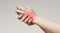 Millennial woman touching her inflamed painful hand