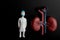 Miniature figurine of a surgeon with a giant pair of kidneys on a black background