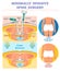 Minimally invasive spine surgery vector illustration. Labeled diagram.