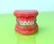 Model of dental appliance showing braces