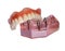 Model of a jaw and denture 2