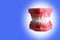 Model of a man`s jaw with even teeth. The concept of care for the oral cavity.