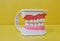 Model of teeth for dentists to explain various tooth diseases or problems in yellow background