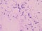 Moderate bacteria cells with Gram stain method.