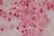 Moderate gram  nagative bacilli with white blood cells