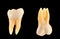 Molar teeth isolated on black