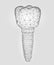 Molar tooth dental implant 3d low poly geometric model. Dentistry innovation future technology titan metal thread