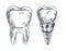 Molar tooth and implant, prothesis, sketch vector