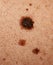 Mole and freckles on the back of a woman. Pigmentation on the back. Close-up