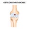 Molecular structure osteoarthritis pain background. Abstract traumatology and orthopedics