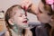 Mom misses zelenkoj sores in a child with chickenpox