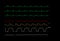 Monitoring display of patient vital signs