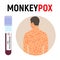 Monkeypox pandemic, test tube, man with smallpox