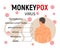 Monkeypox symptoms infographic. Banner with text