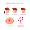 Monkeypox symptoms vector illustration