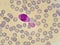 Monocyte and malaria parasite