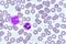 Monocyte and neutrophil cell in blood smear