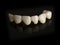 Monolithic zirconia restorations full arch implant supported wit