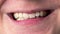 Montage collage of happy toothy smile many people, smiling mouth of children, female and male diverse lips, dentistry