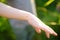 Mosquito sitting on the hand of child. Gnat sucking blood. Danger of bite of an insect. Use repellent for safety kids during