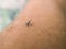 Mosquito use needle to suck a blood on human skin.