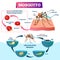 Mosquito vector illustration. Labeled insects species with malaria disease.