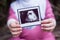 A mother holds a picture of her child