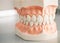 Mould of human teeth. Oral health concept. Mould of human teeth. Close up dental gypsum model. Plaster cast human jaws prothetic