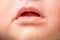 Mouth and lips of newborn